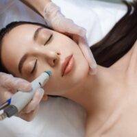 Hidrafacial - Center Laser Cali