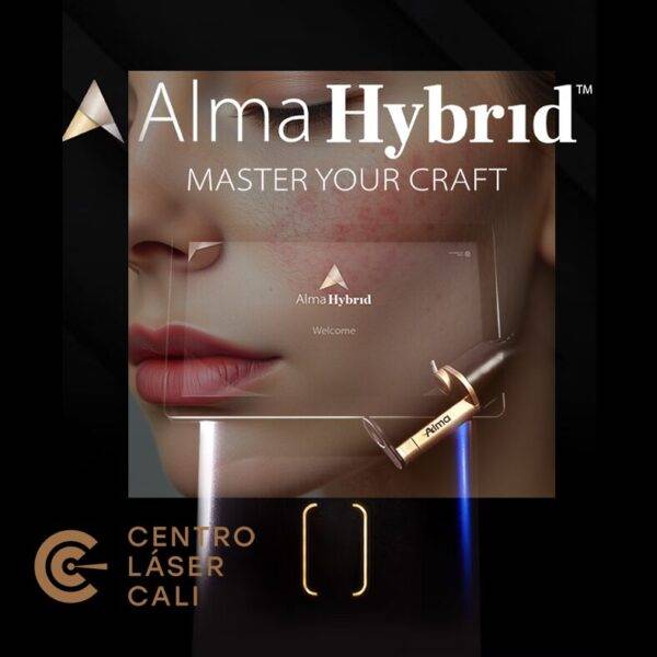 ALMA HYBRID (CICATRICES DE ACNÉ) - TRATAMIENTO EN CALI