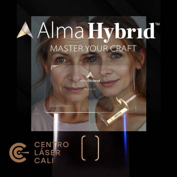 ALMA HYBRID (REJUVENECIMIENTO FACIAL LÁSER) - TRATAMIENTO EN CALI